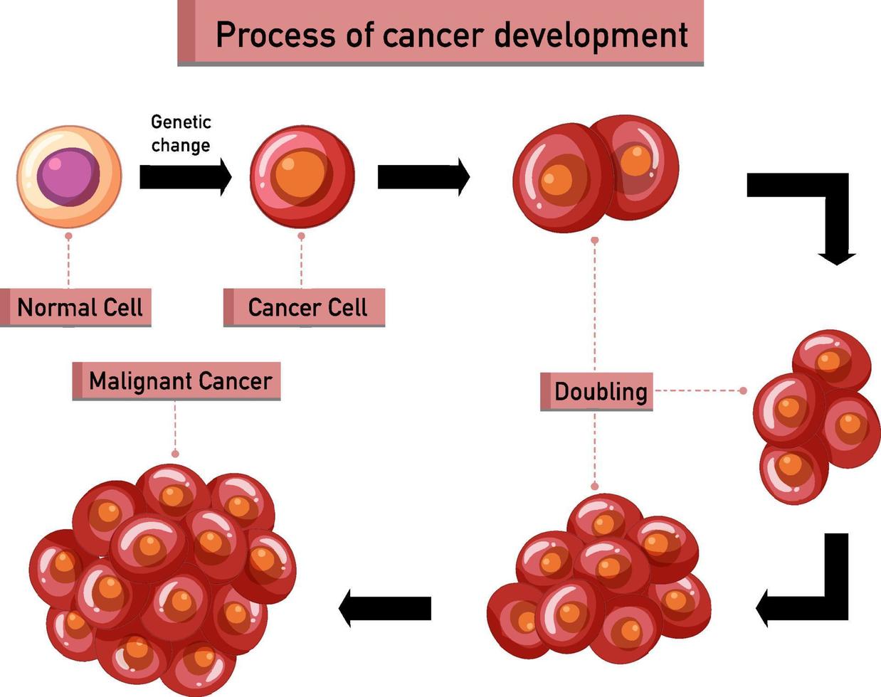 Infografía del proceso de desarrollo del cáncer. vector