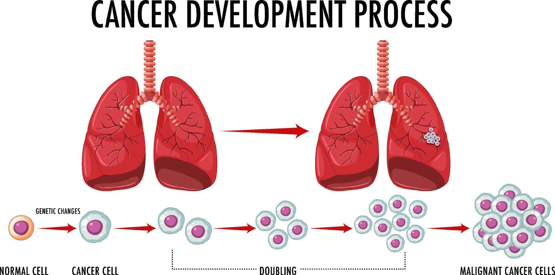 Process of cancer development infographic vector