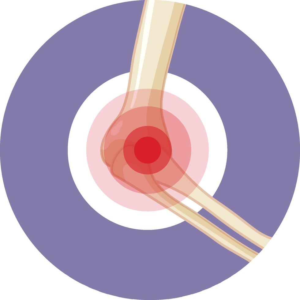 Elbow joint with a pain or injury vector