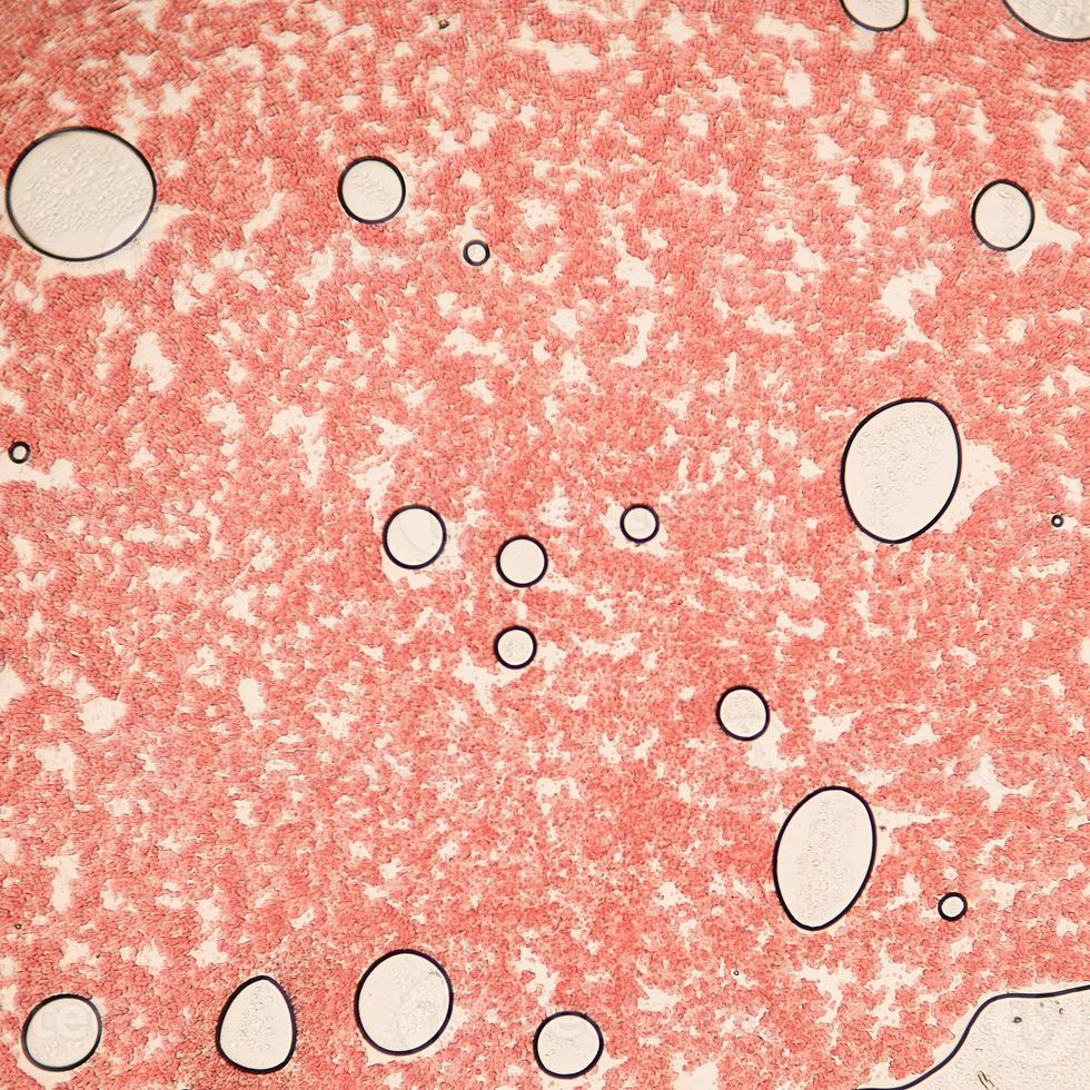 Blood smear under microscope present neutrophils and red blood cells. Photo micro sections with high magnification with light microscope