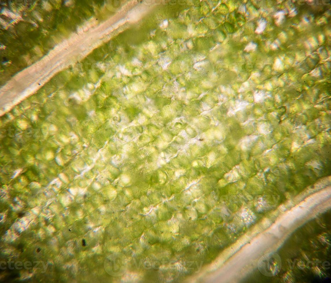 Leaf cells under microscope. micrograph, leaf under a microscope, organ-producing oxygen and carbon dioxide, the process of photosynthesis photo