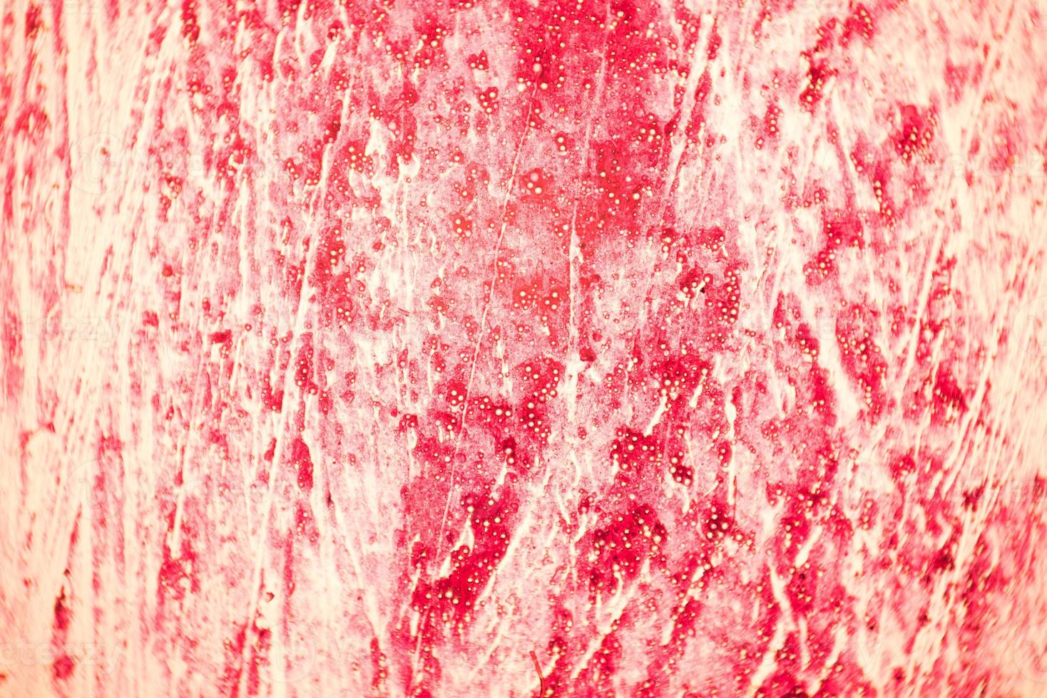 Cross section of the human tissue in the microscope view. photo