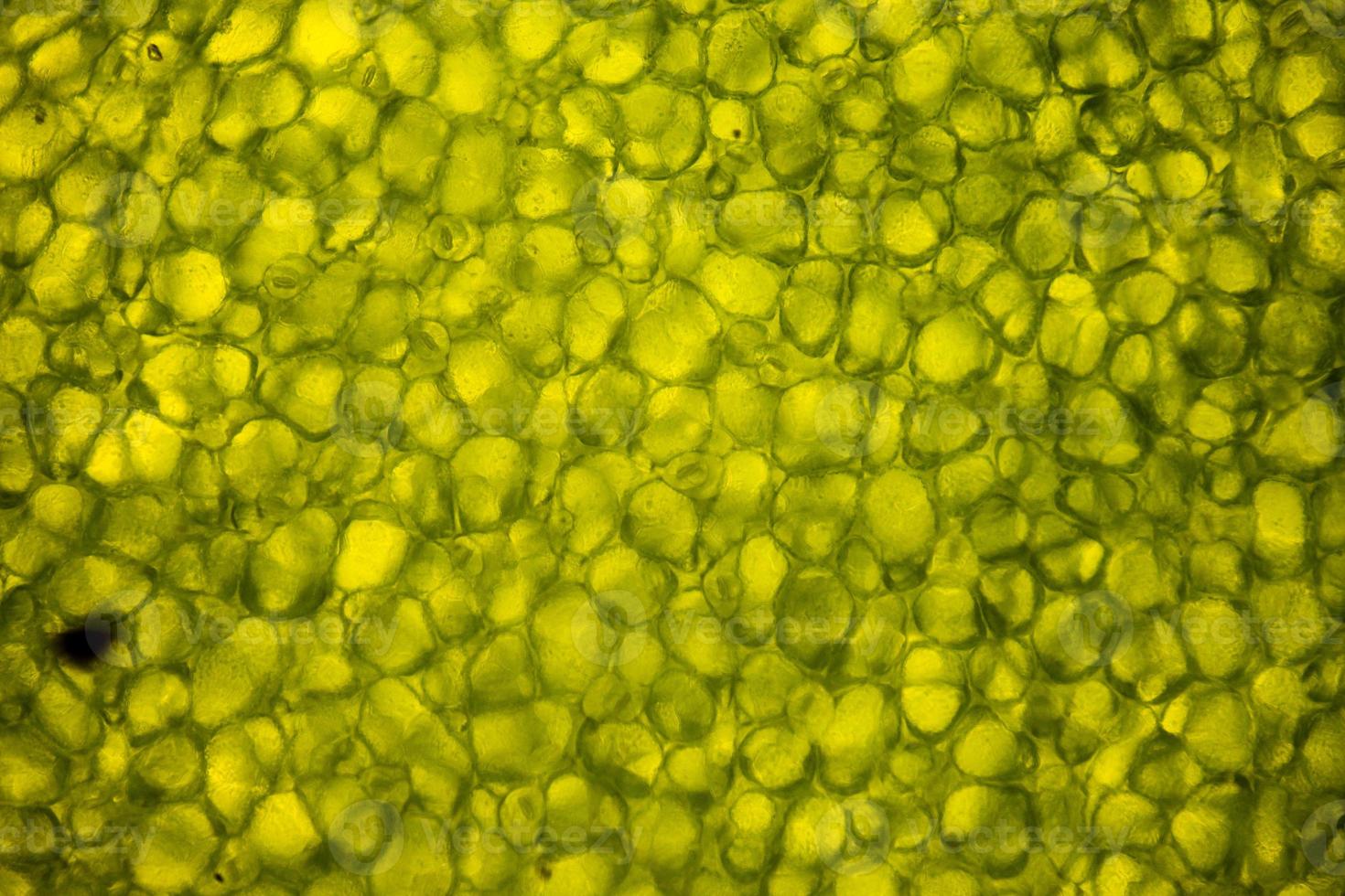 Leaf cells under microscope. micrograph, leaf under a microscope, organ-producing oxygen and carbon dioxide, the process of photosynthesis photo