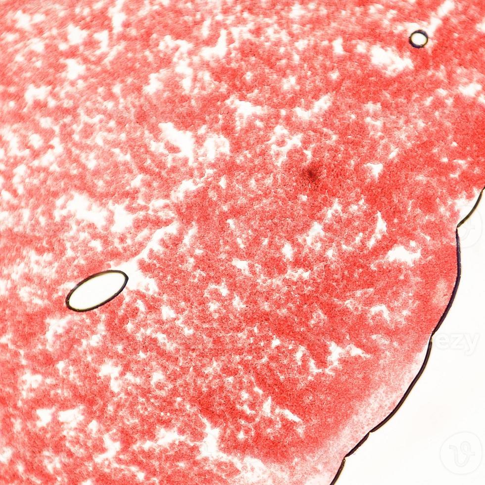 Blood smear under microscope present neutrophils and red blood cells. Photo micro sections with high magnification with light microscope