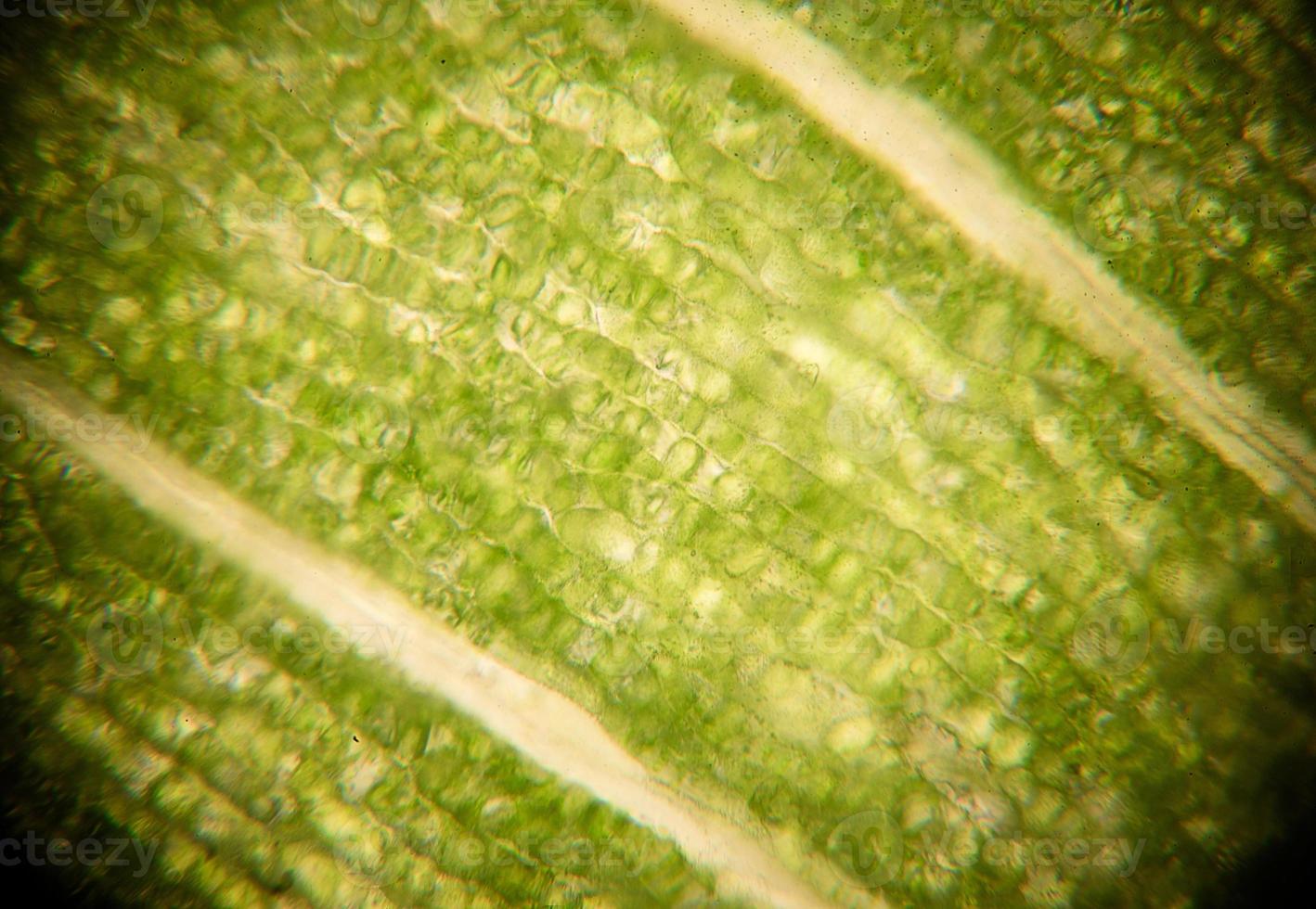 Leaf cells under microscope. micrograph, leaf under a microscope, organ-producing oxygen and carbon dioxide, the process of photosynthesis photo