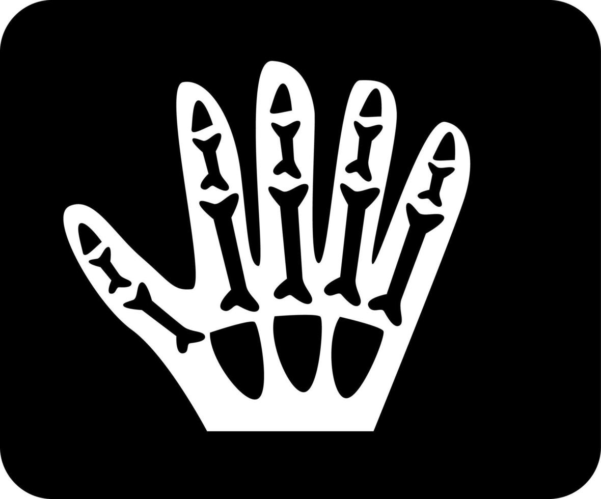 Cartoon x-ray scan of a hand with visible bones. vector