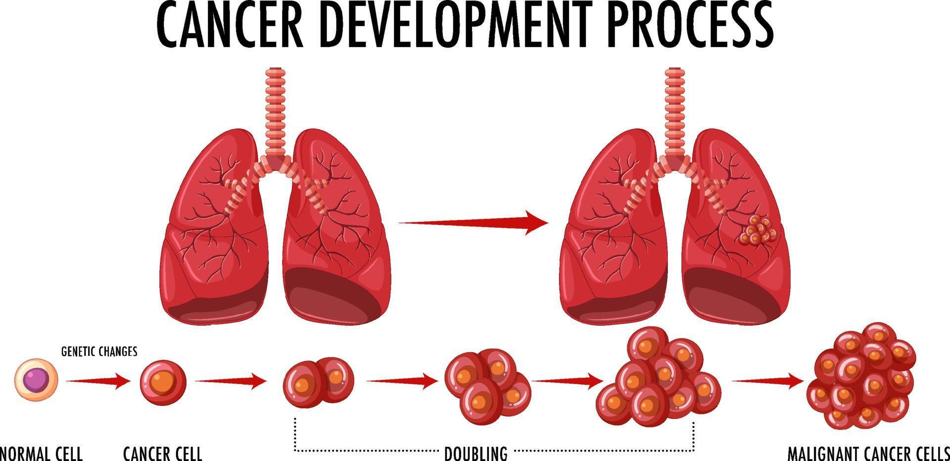 infografía del proceso de desarrollo del cáncer vector