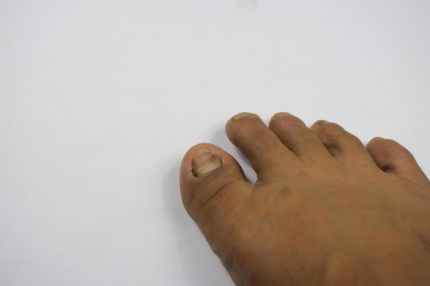 feet of a young man with tan skin tone, white background photo