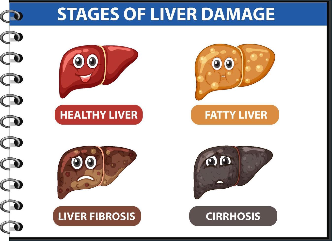 Diagram showing stages of liver damage vector