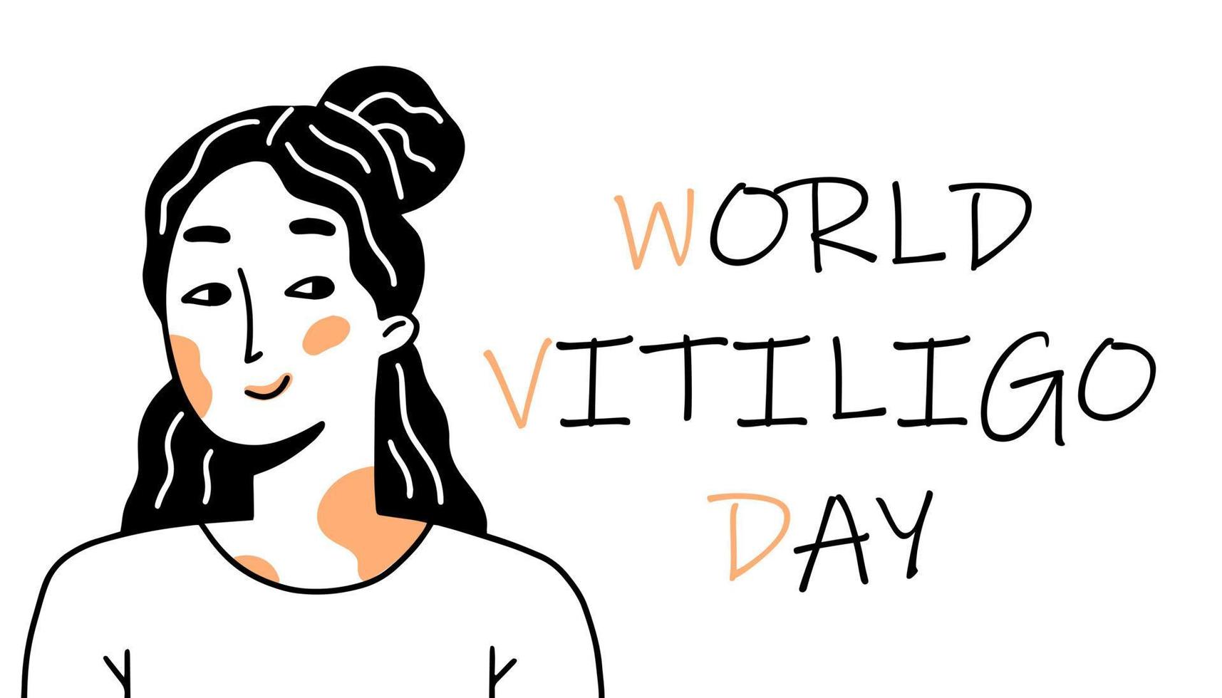 World vitiligo day poster. A smiling girl with problematic vitiligo skin in a doodle style. Vector illustration.