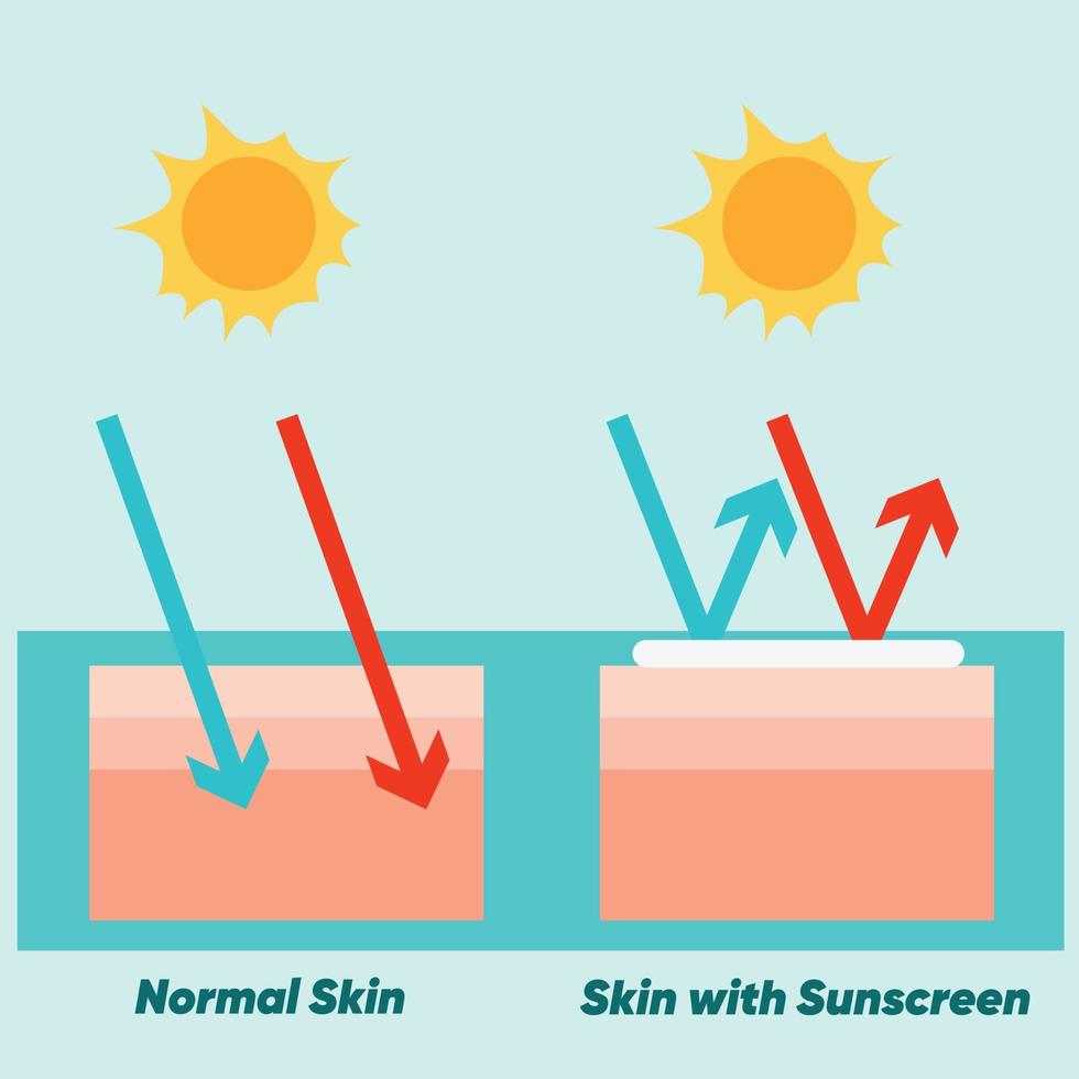 skin care concept,sunscreen, sunblock,Sun protection on skin layer.Comparison of normal skin and skin with sunscreen.Vector cartoon. vector