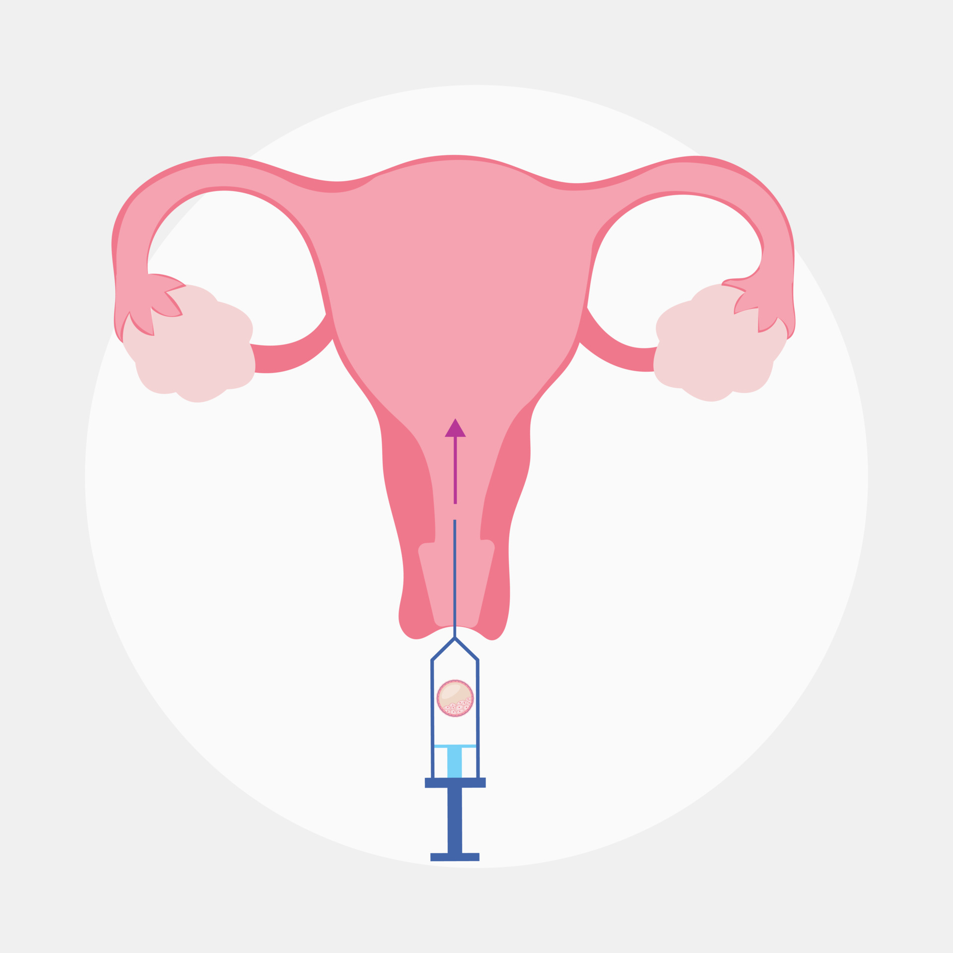 Frozen Embryo Transfer concept illustration 6331601 Vector Art at Vecteezy