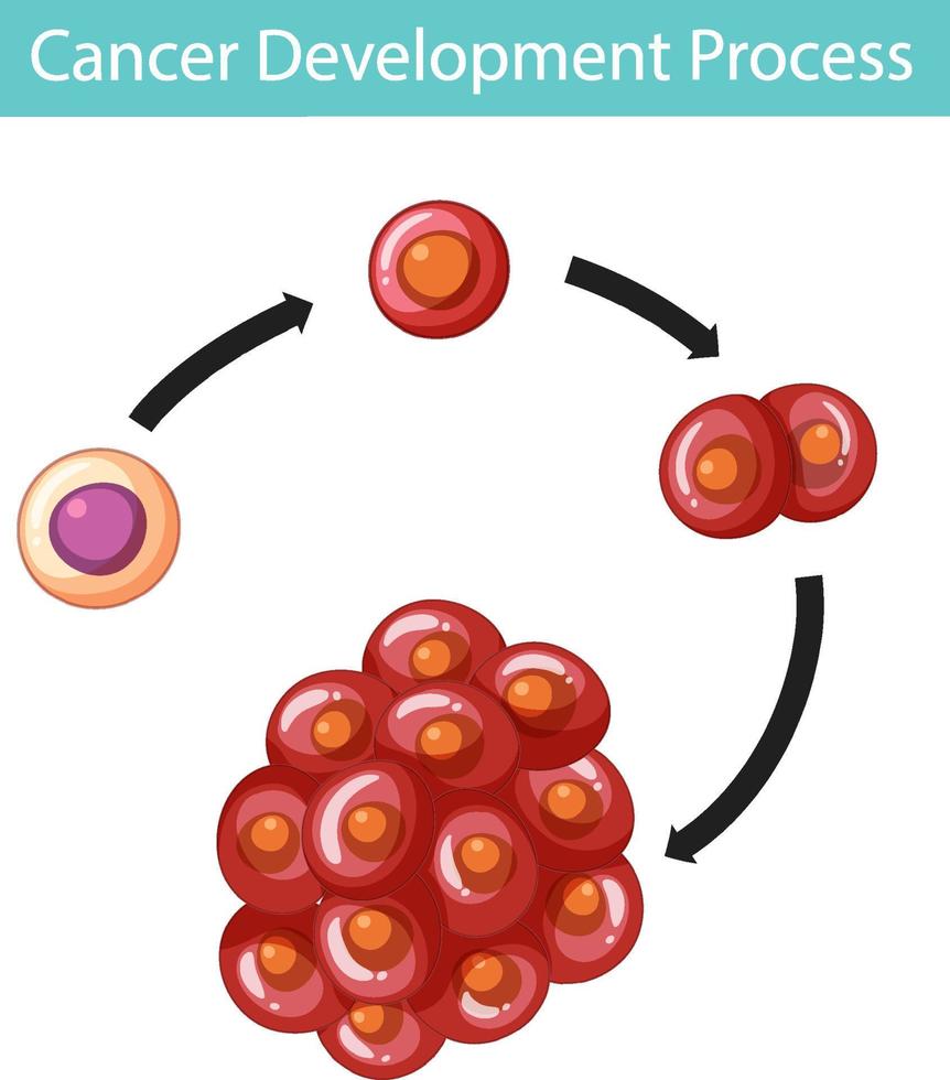 Cancer Development Process infographic vector
