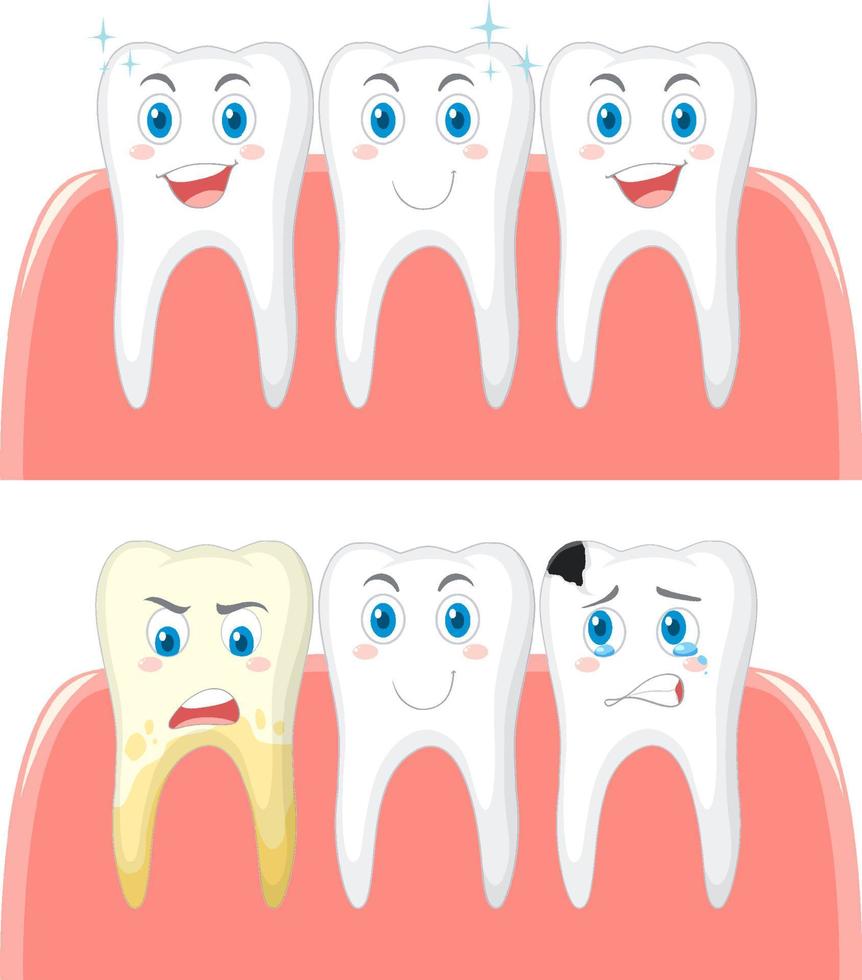 Set of strong teeth and tooth decay on white background vector