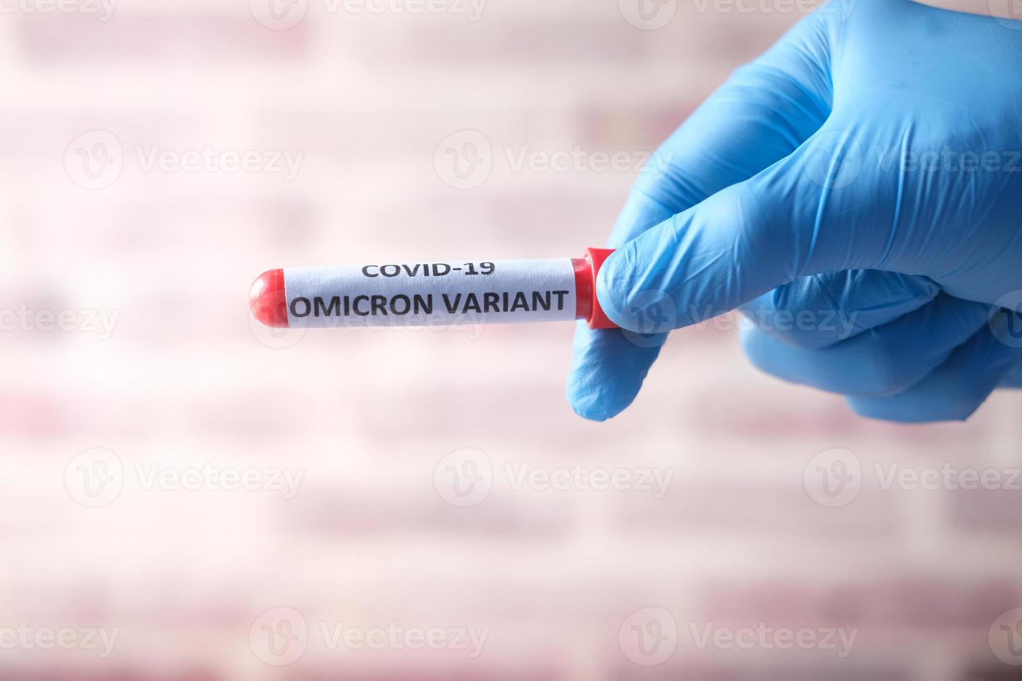 hand hold omicron variant corona virus blood test tube photo