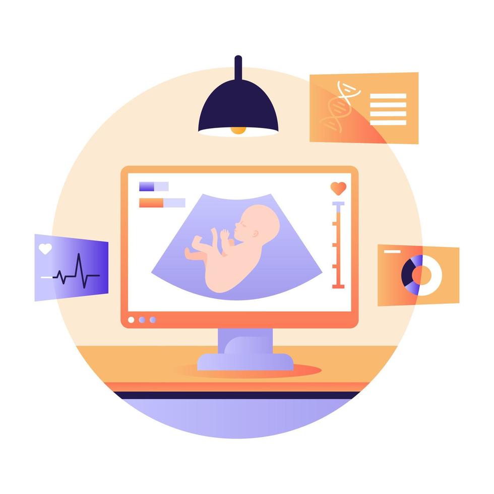 Modern flat illustration of sonography vector