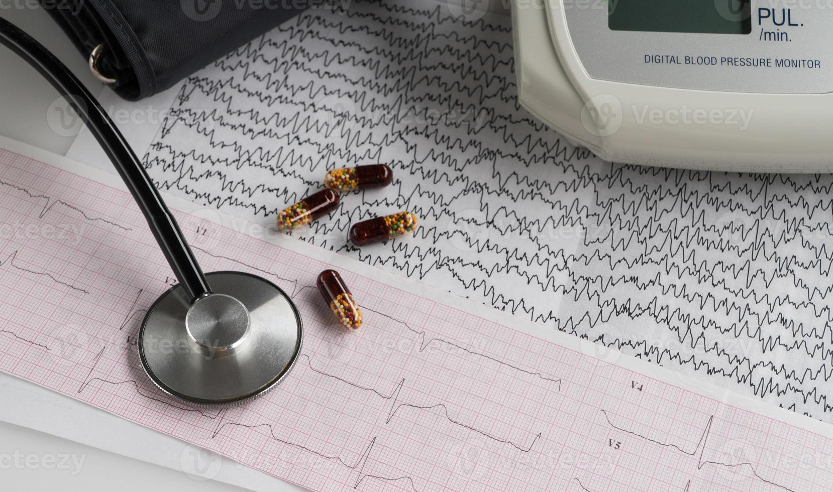 modern electric tonometer and a stethoscope on a cardiogram chart. household blood pressure monitor photo