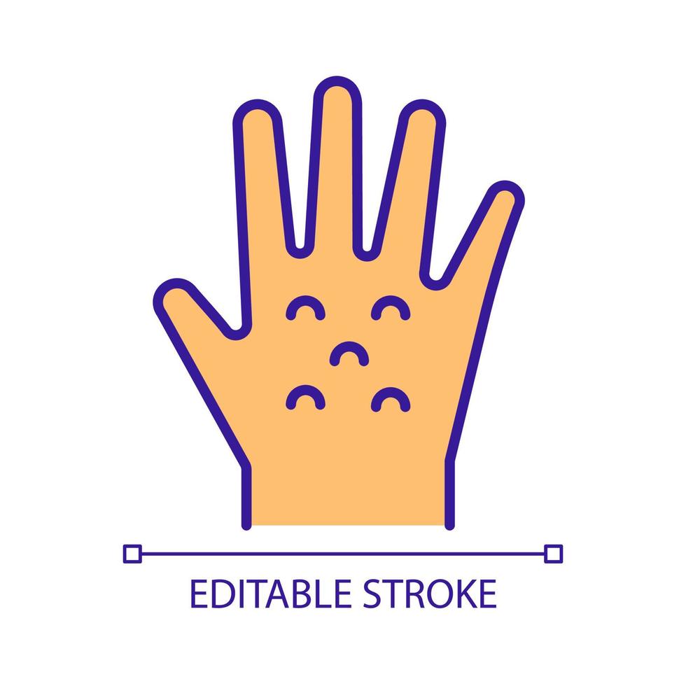 Allergic reaction on hands RGB color icon. Hand rashes. Contact dermatitis. Irritant skin reactions. Bodily infections. Isolated vector illustration. Simple filled line drawing. Editable stroke