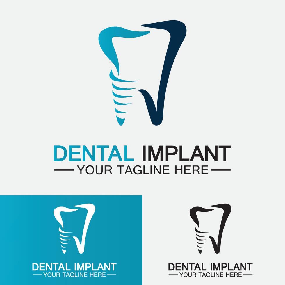 Dental implant logo vector  designs concept