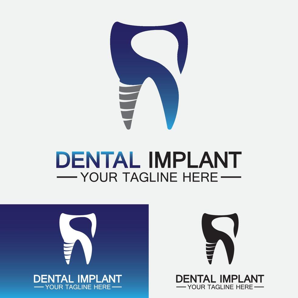 Dental implant logo vector  designs concept