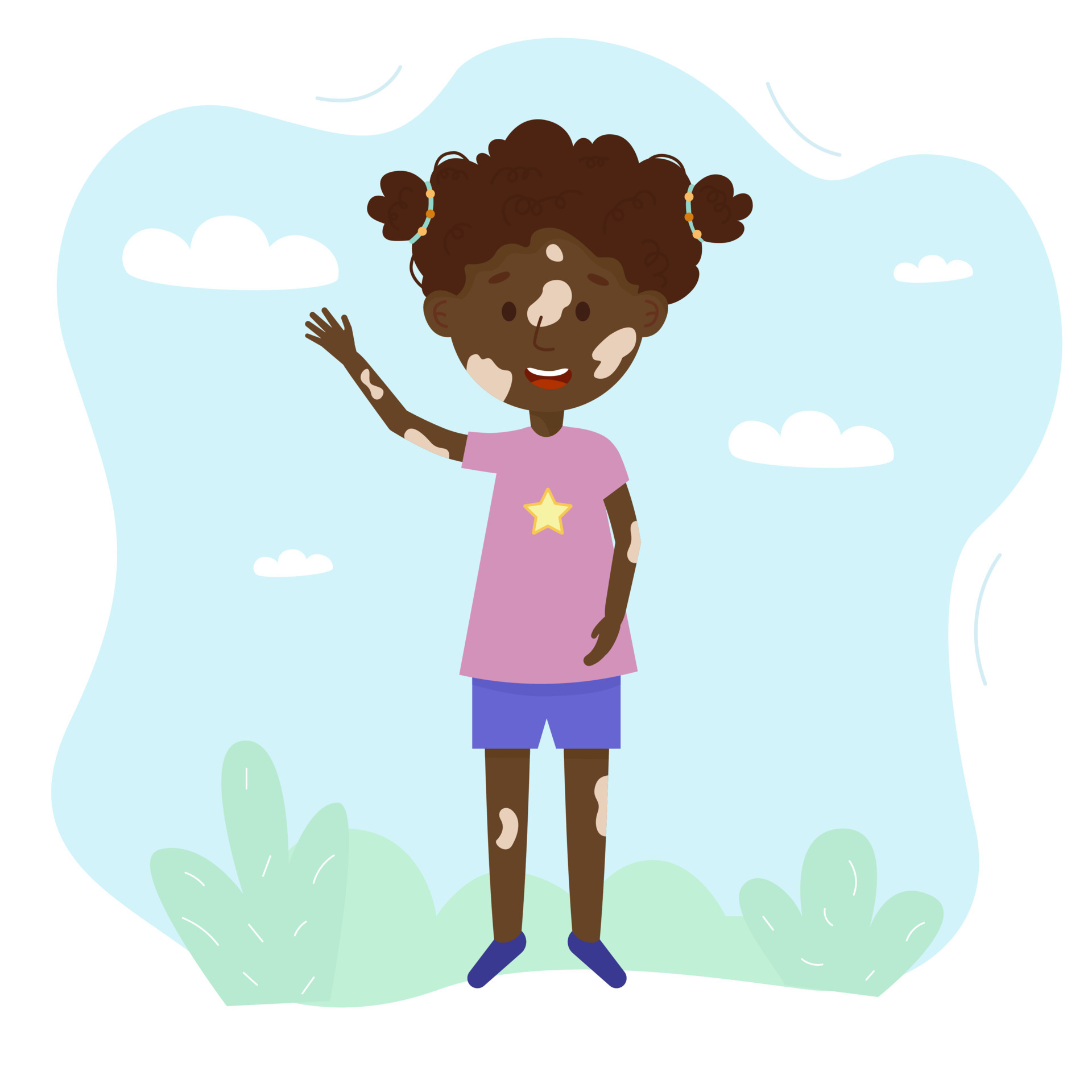 Cartoon vector illustration of happy girl with vitiligo syndrome. Body