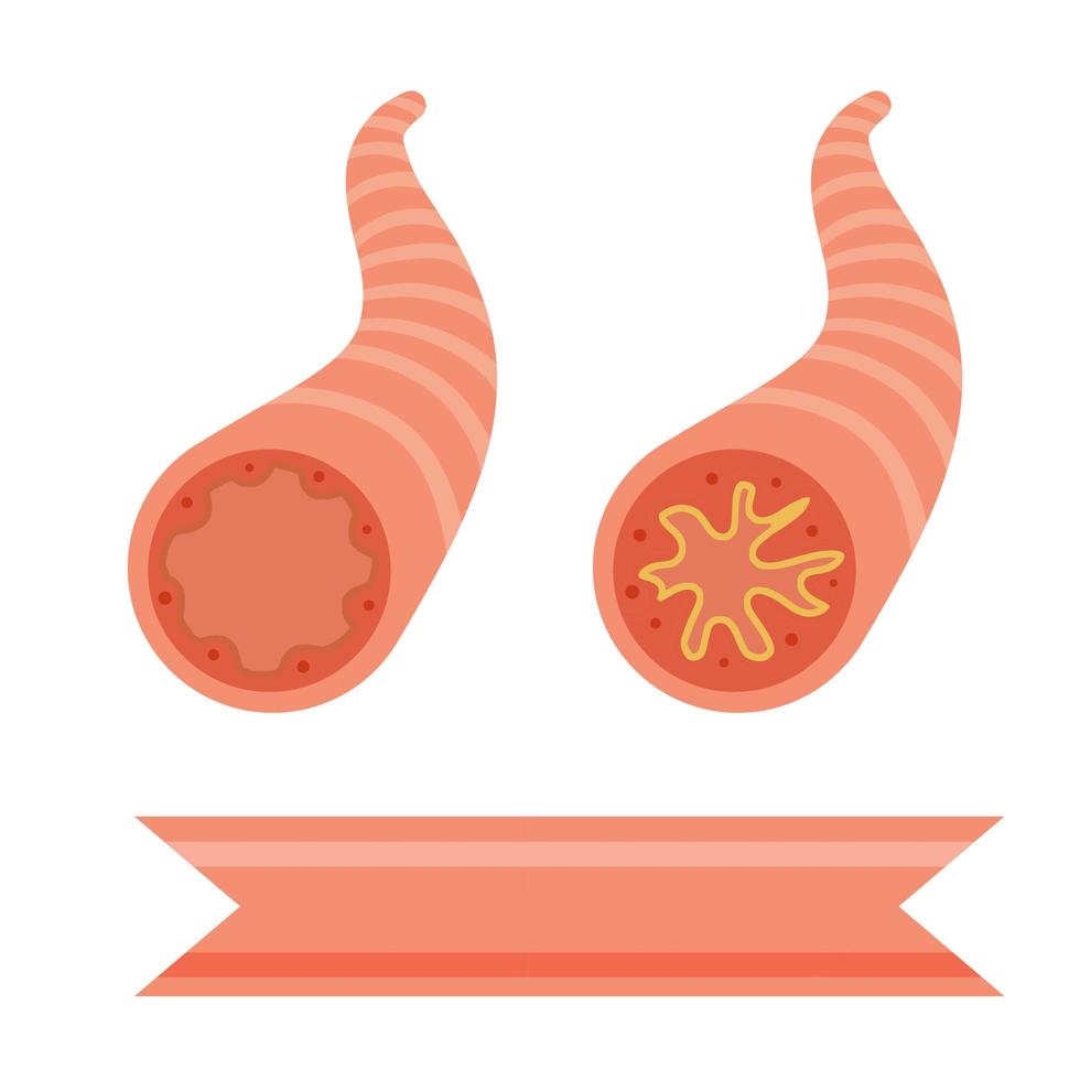 Asthma. The medical scheme. Respiratory tract disease. vector