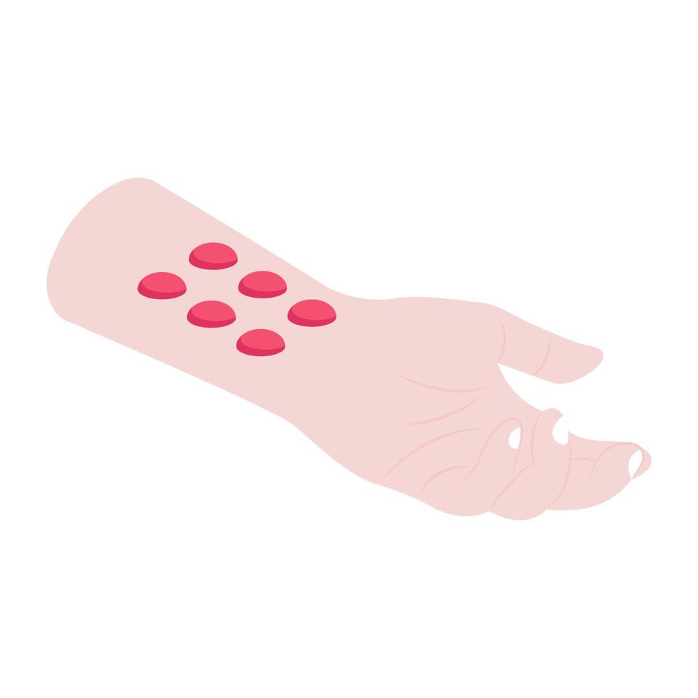 Isometric vector of skin prick test, medical test