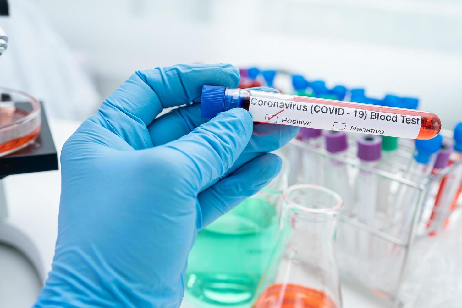 Positive blood infection sample in test tube for covid-19 coronavirus in lab. Scientist holding to check and analyze for patient in hospital. photo