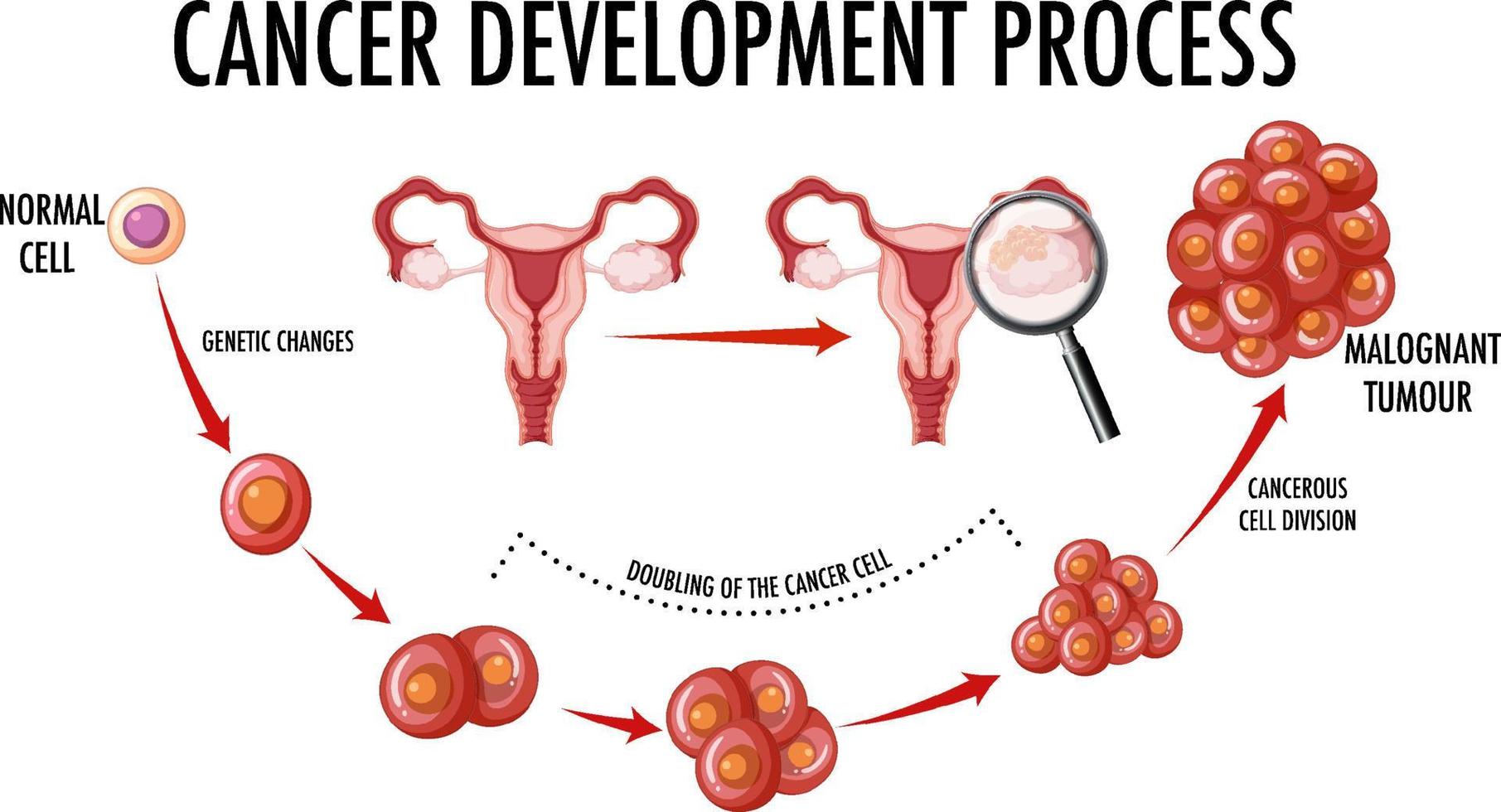 Diagram showing cancer development process vector