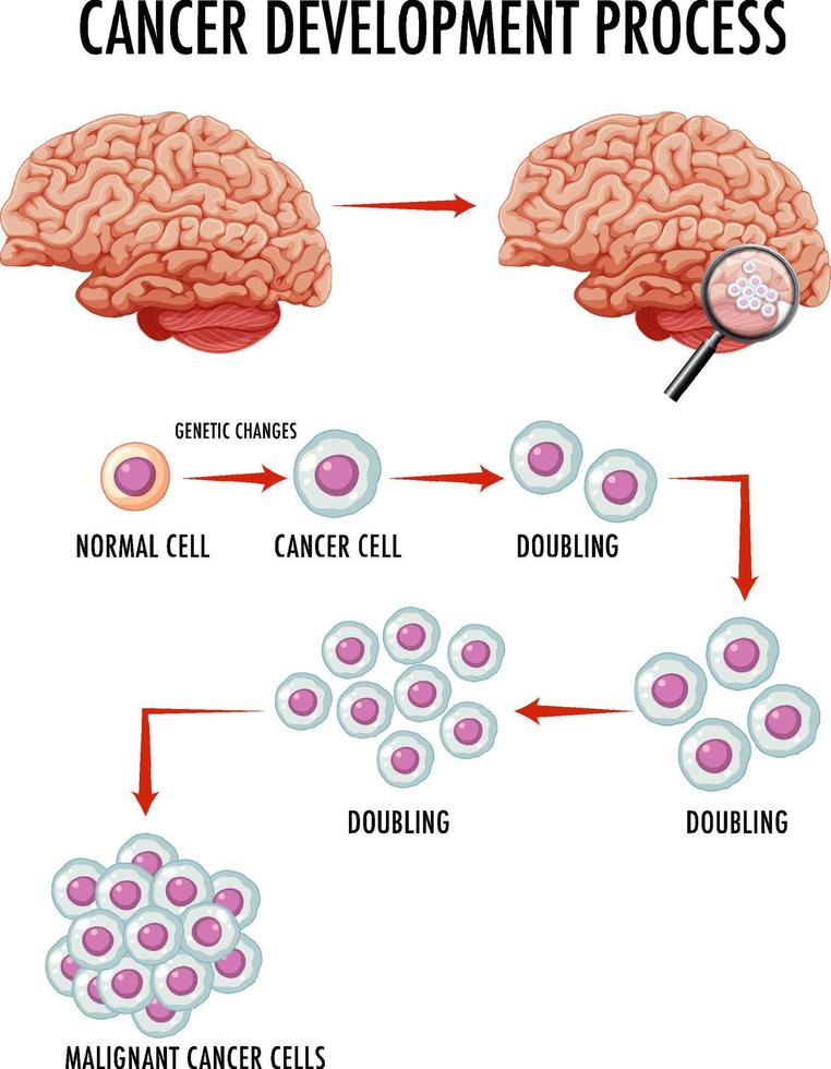 Diagram showing cancer development process vector