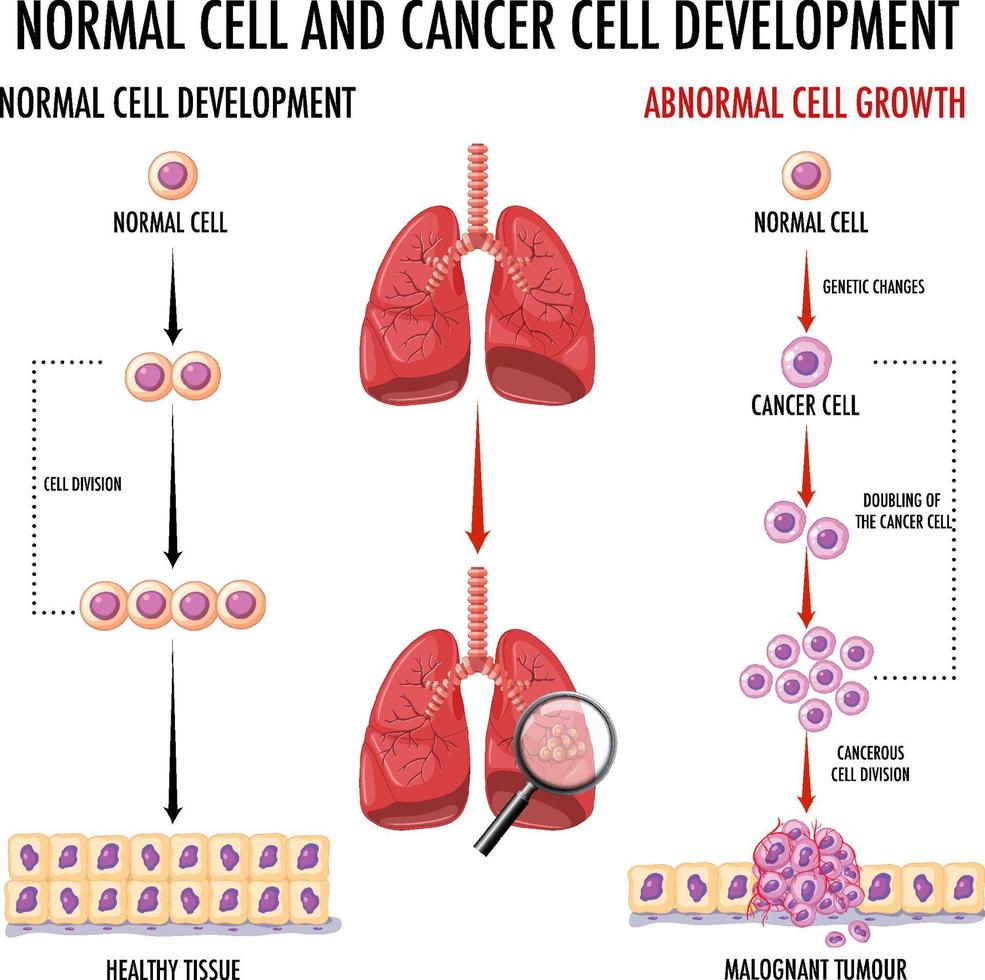 diagrama que muestra células normales y cancerosas en humanos vector