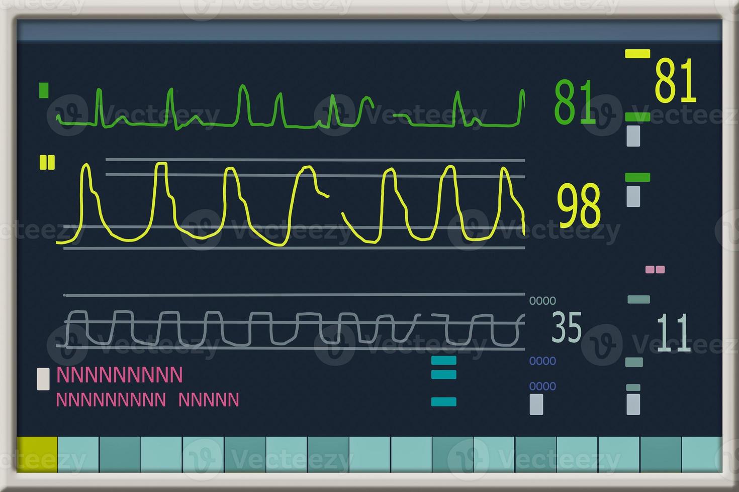 Patient monitor showing vital signs ECG and EKG. Vector illustration. photo