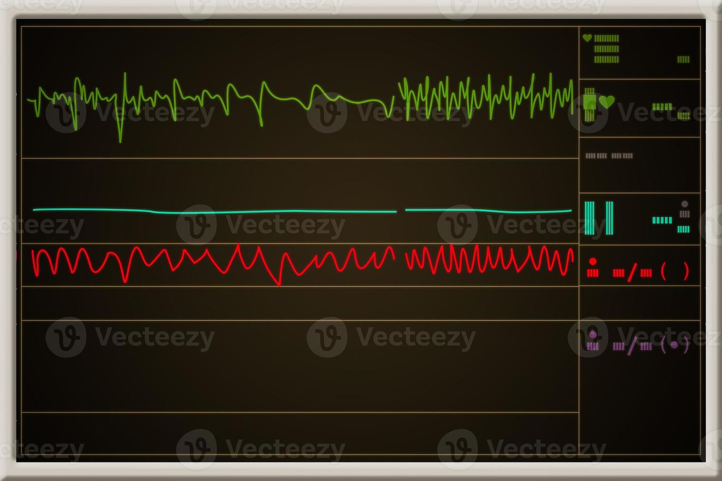 Patient monitor showing vital signs ECG and EKG. Vector illustration. photo