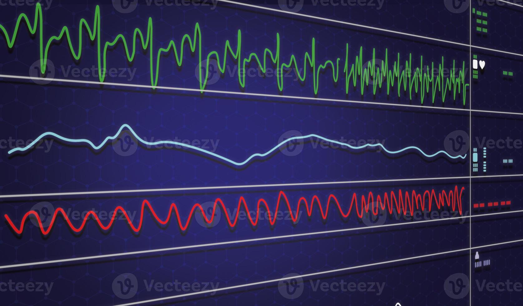 EKG monitor in intra aortic balloon pump machine in icu on blur background, Brain waves in electroencephalogram, heart rate wave photo