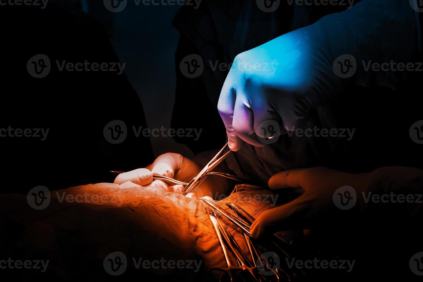 Pictures of surgery performed by a specialist surgeon. Color tones distinguish blue and orange. photo