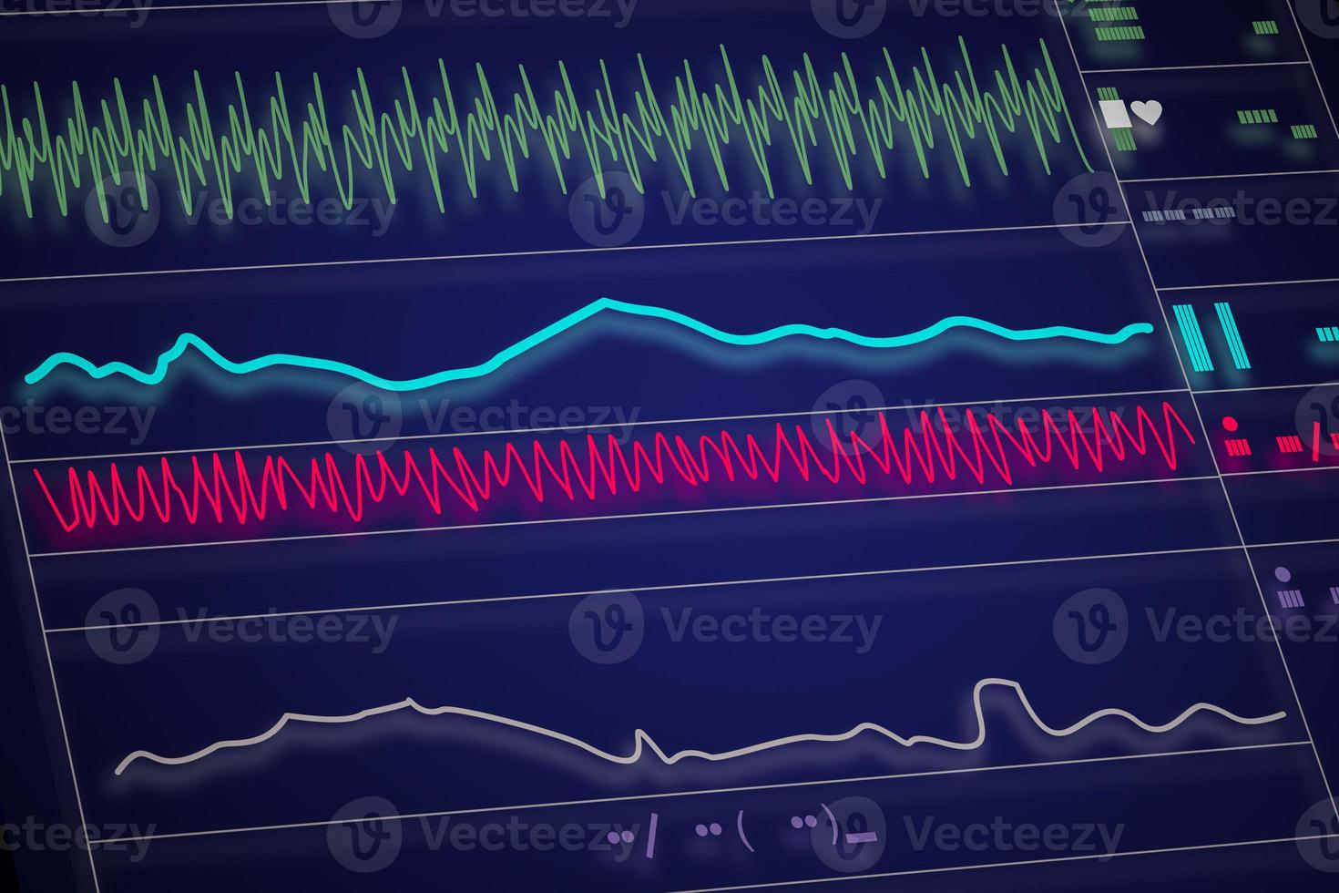 Patient monitor showing vital signs ECG and EKG. Vector illustration. photo