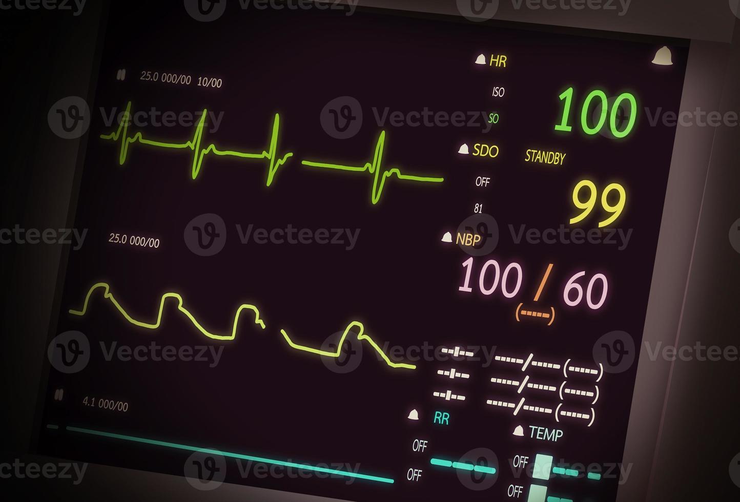 Patient monitor showing vital signs ECG and EKG. Vector illustration. photo