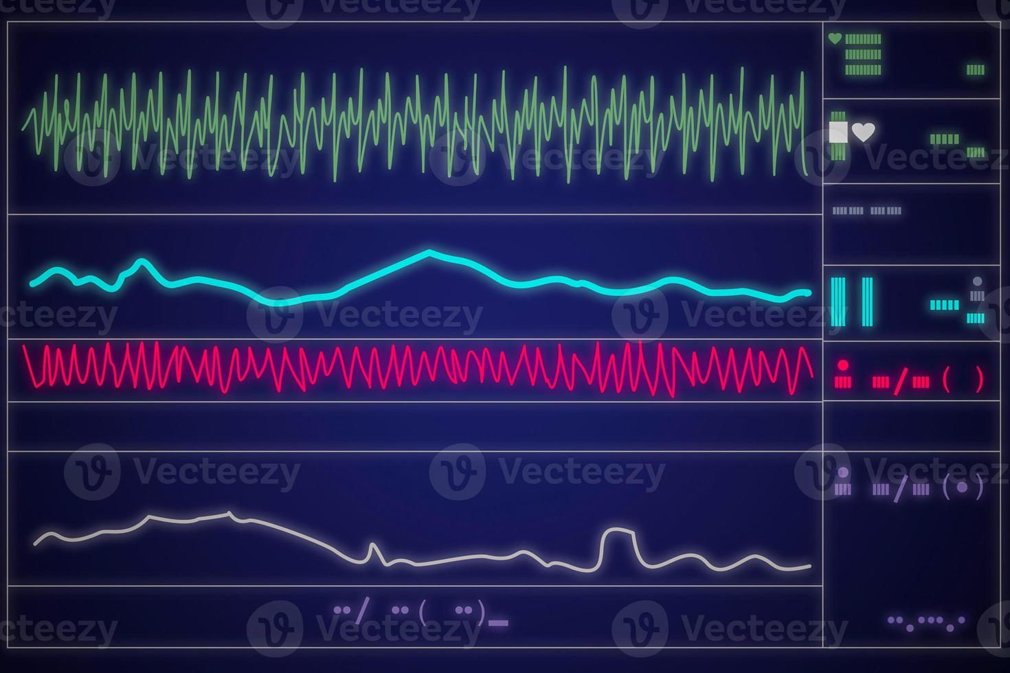 Patient monitor showing vital signs ECG and EKG. Vector illustration. photo