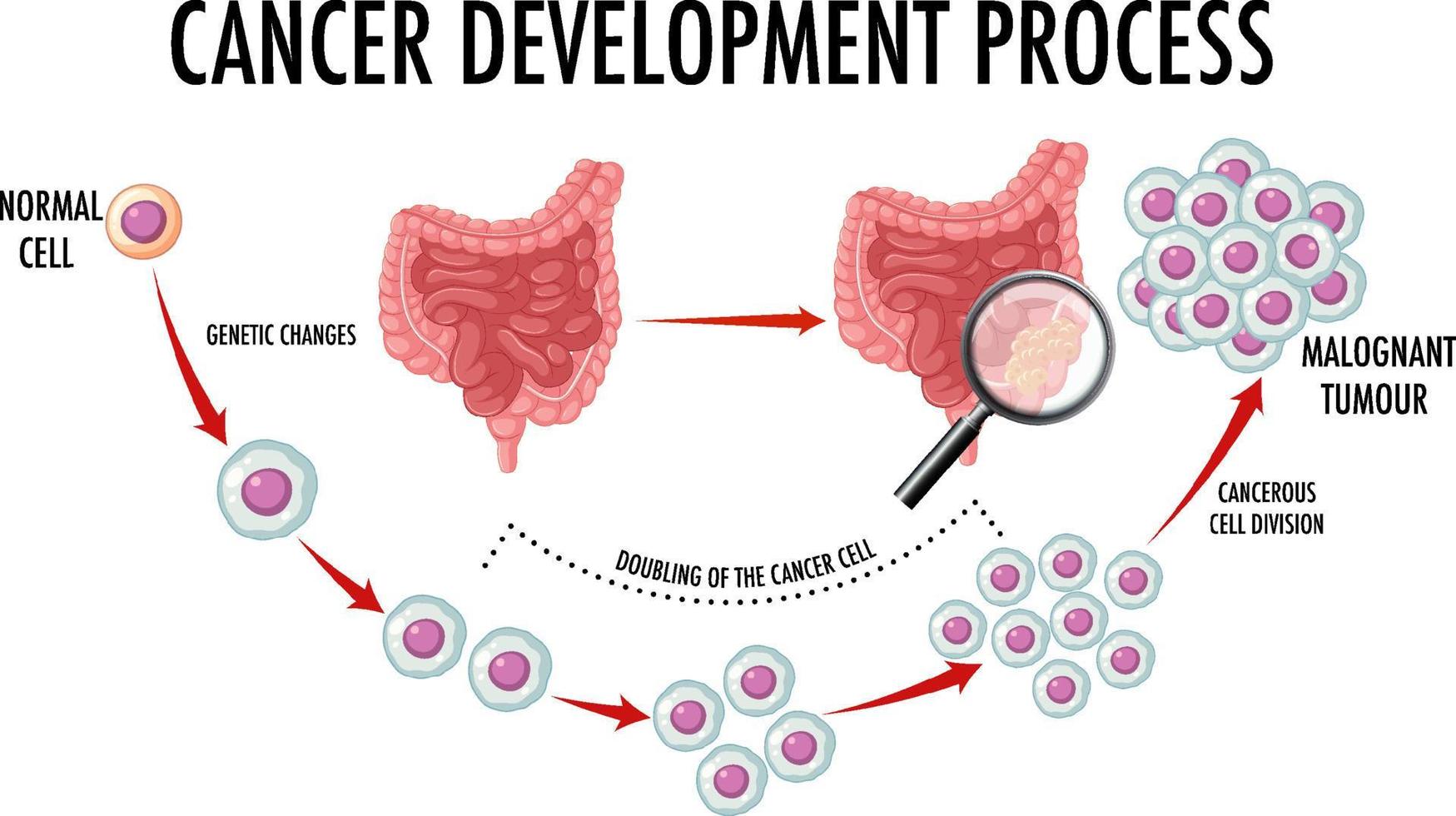 Diagram showing cancer development process vector