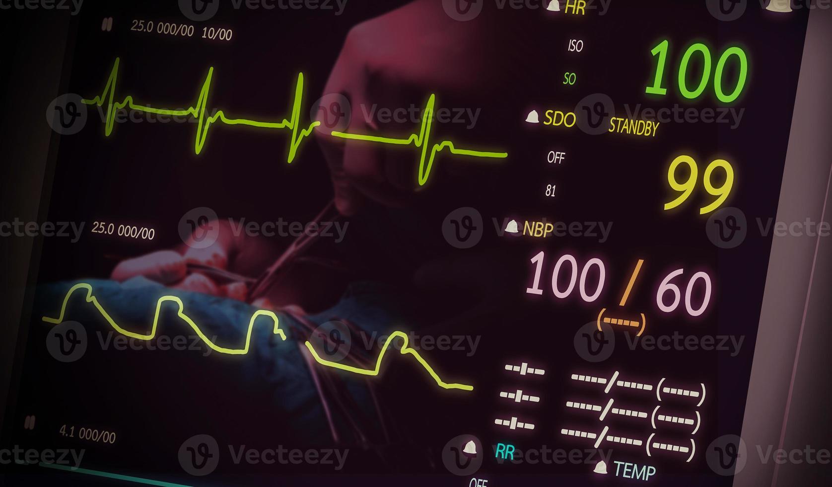 Patient monitor showing vital signs ECG and EKG. Vector illustration. photo