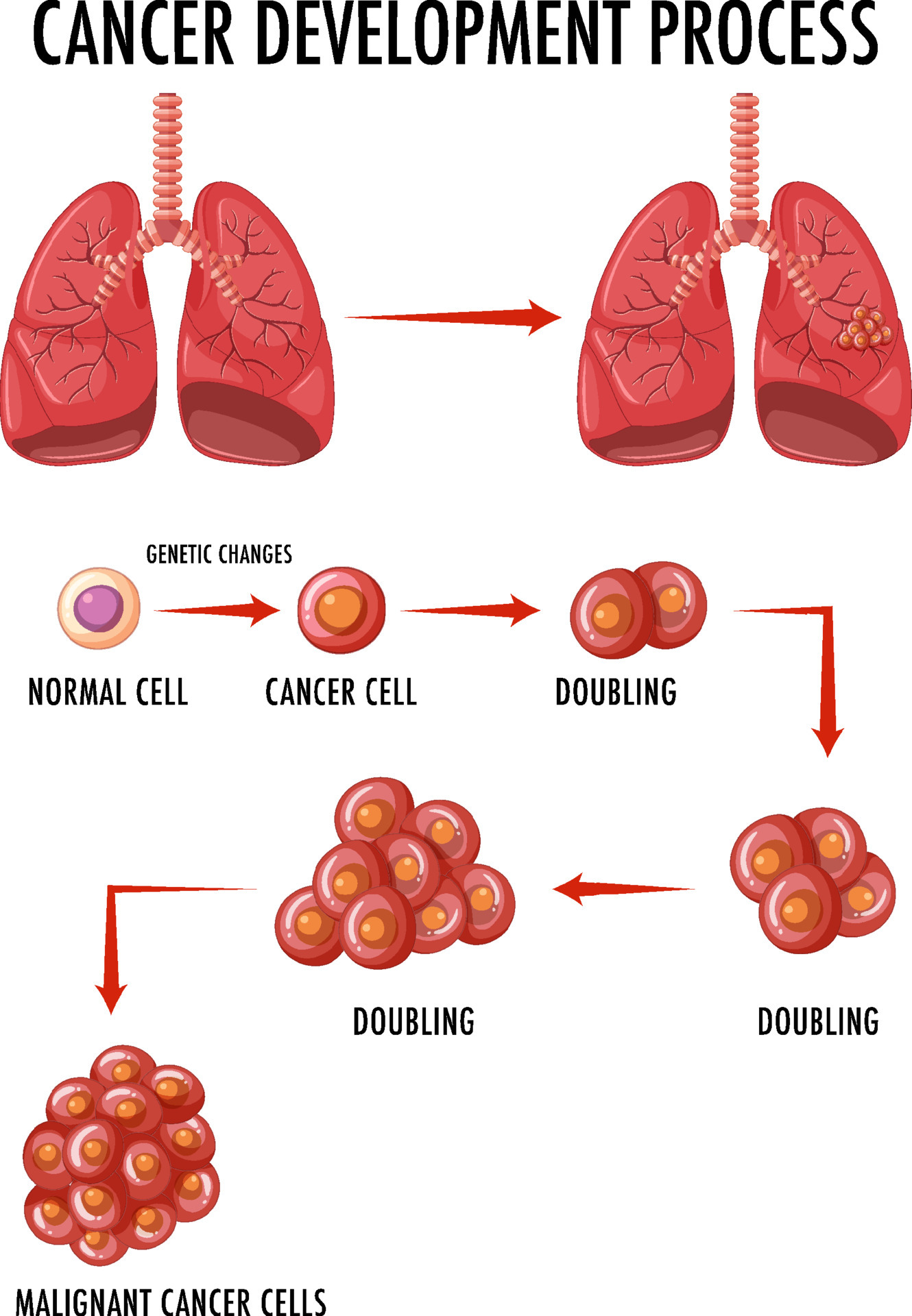 Diagram showing normal and cancer cells in human 6591688 Vector Art at  Vecteezy