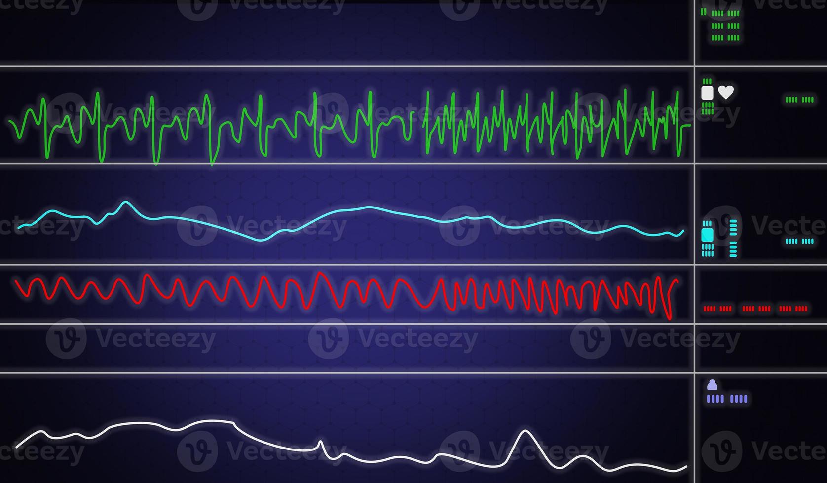 Patient monitor showing vital signs ECG and EKG. Vector illustration. photo