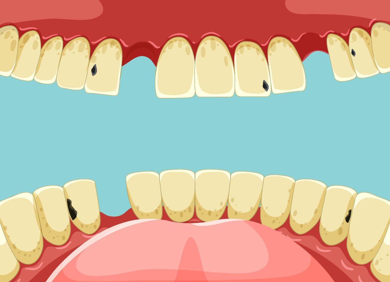 Human teeth inside mouth with yellow broken tooth vector