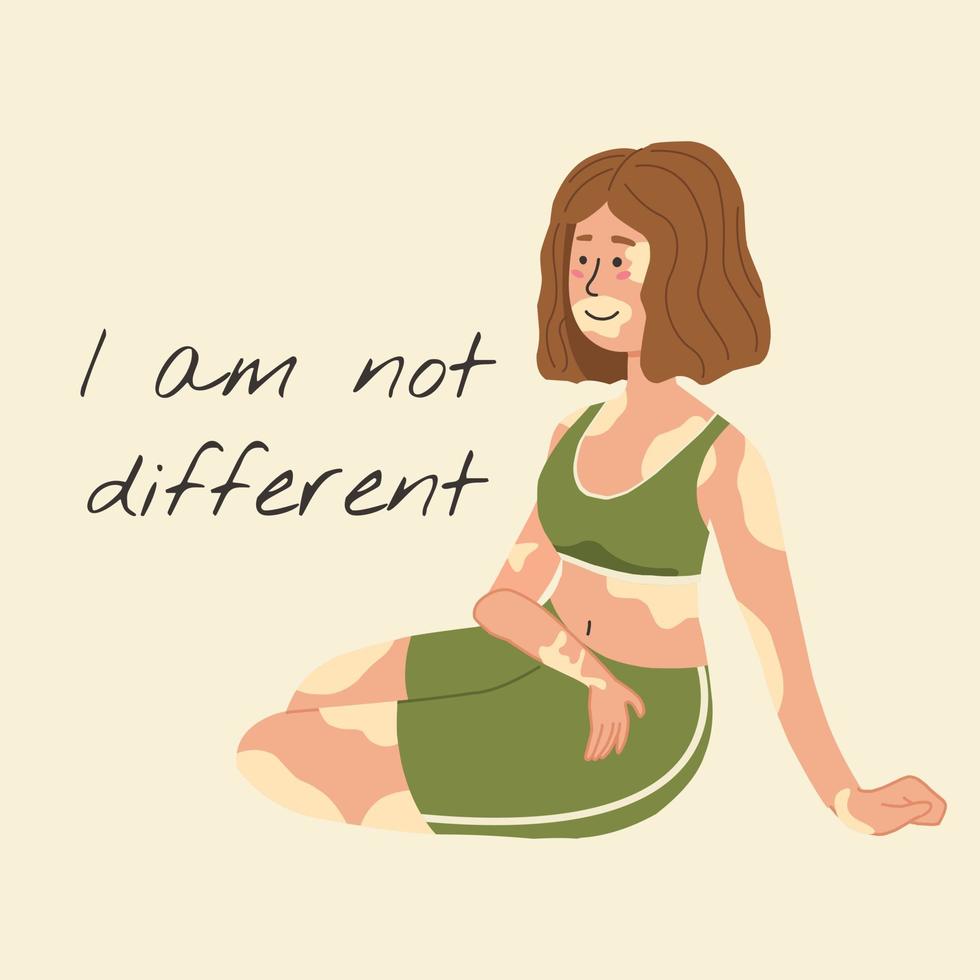 Vector illustration in a flat style. A girl with skin depigmentation. Vitiligo disease. I am not different