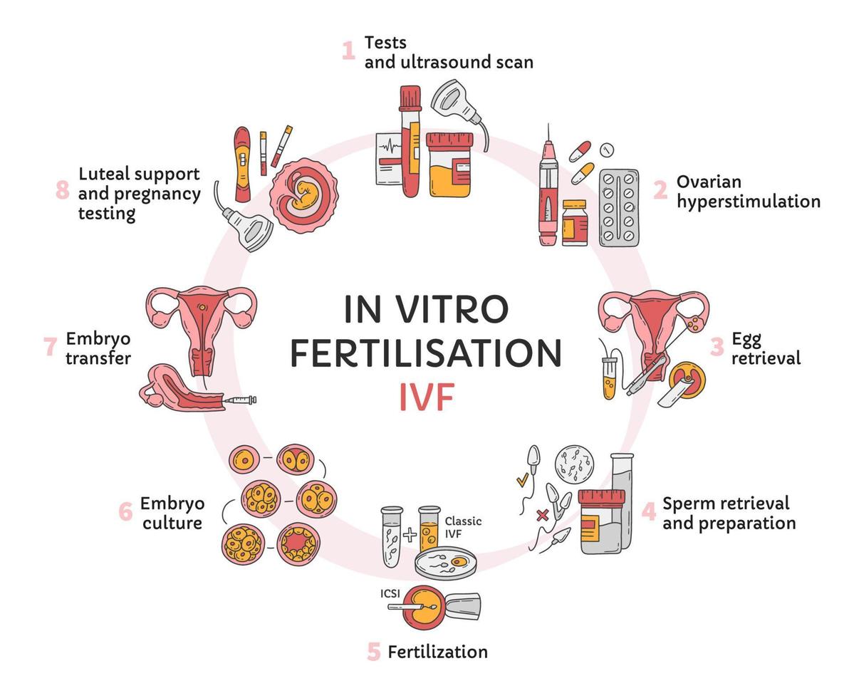 fertilización in vitro ivf círculo vectorial infográfico, esquema de tratamiento de infertilidad. hiperestimulación ovárica, inseminación artificial, cultivo de embriones, soporte lúteo. procedimiento medico para el embarazo vector