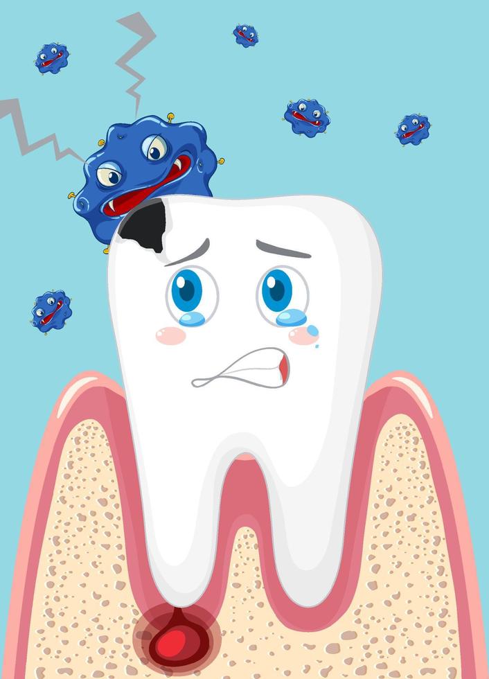 caricatura, caries, con, bacterias, en, fondo azul vector