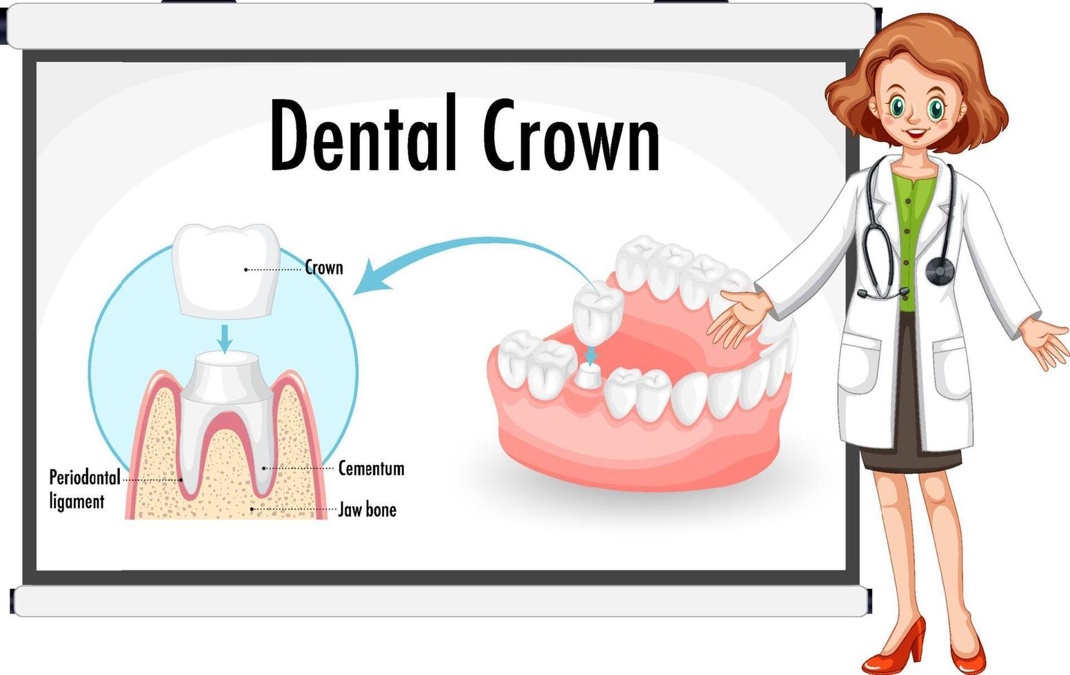 Infographic of human in dental crown vector