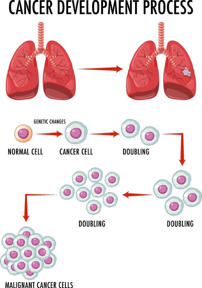 Diagram showing cancer development process vector