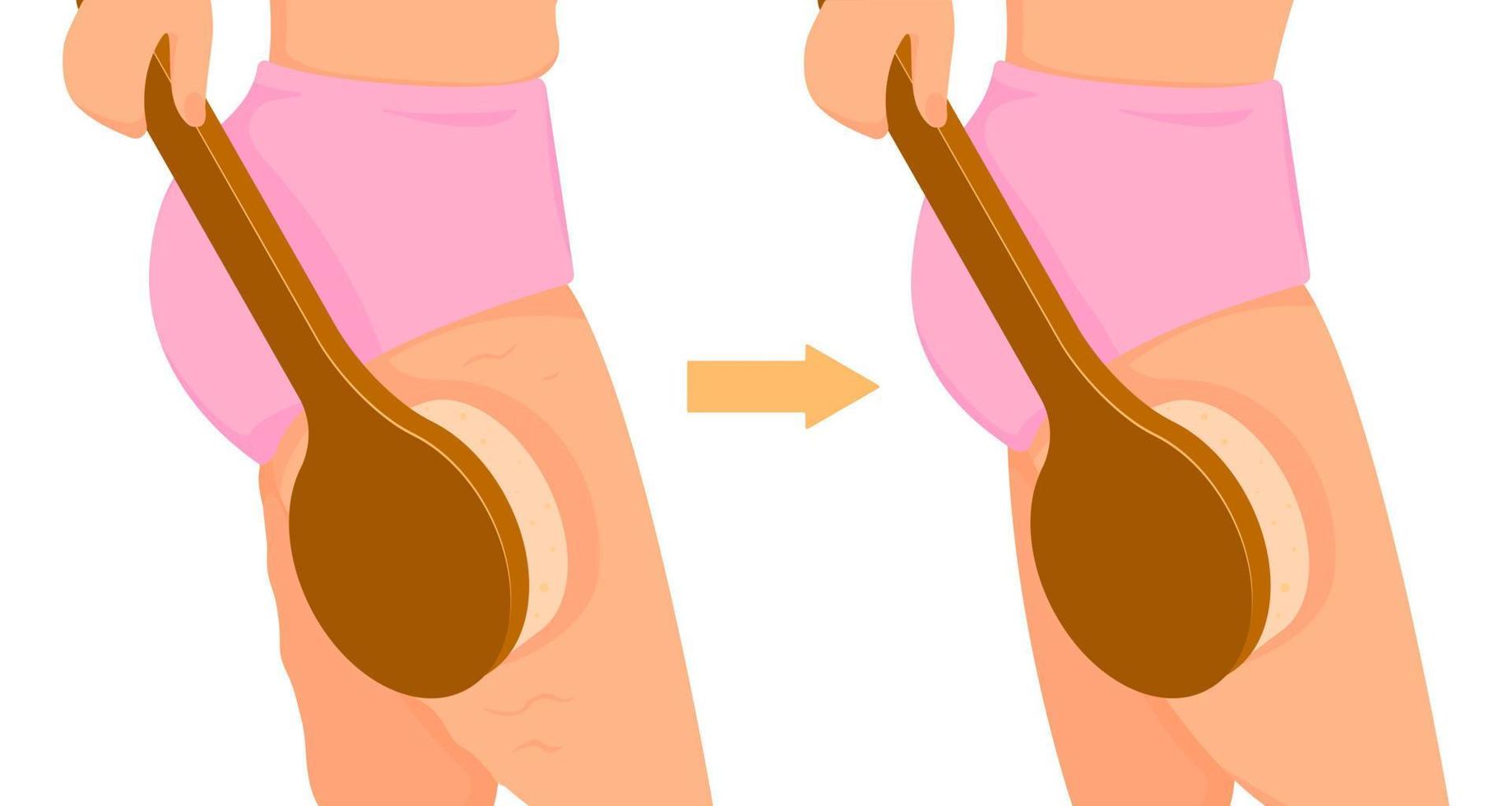 Anti-cellulite massage with a brush. Dry brushing to get rid of cellulite on the thighs. Body care and beauty concept. vector