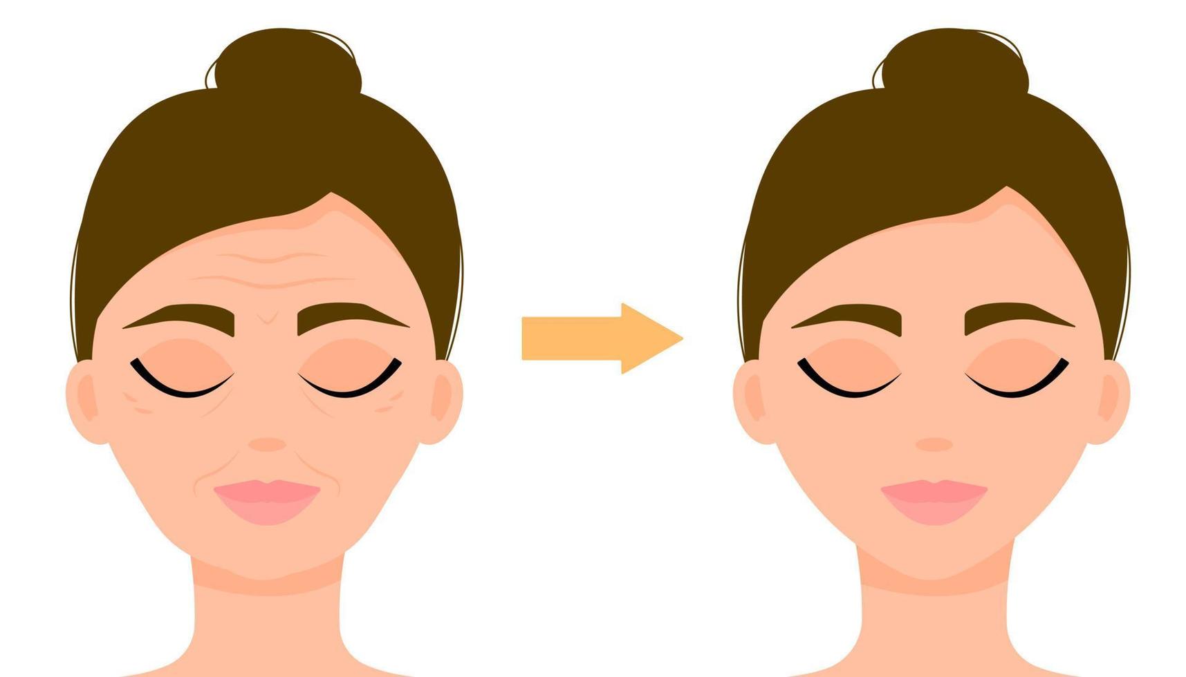 arrugas, signos de edad en el rostro de una mujer. el resultado del procedimiento. cosmetología, masaje. antes y después del procedimiento. ilustración vectorial vector